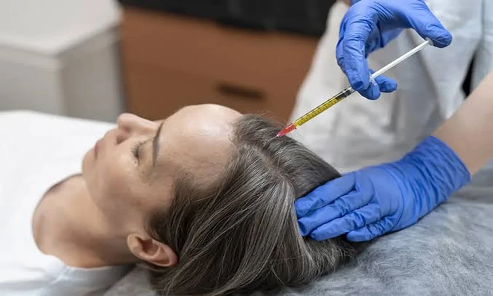 Choosing PRP Hair Treatment Based on Individual Hair Loss Requirements